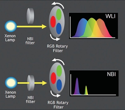 LEDs in Endoscopic Narrowband Imaging